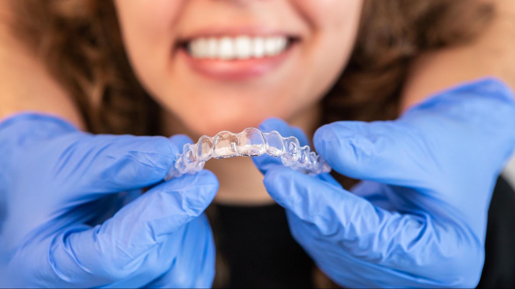 Aligners